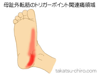 母趾外転筋の足の痛みの領域