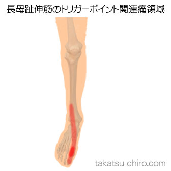長母趾伸筋の足の痛みの領域