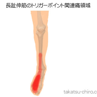 長趾伸筋の足の痛みの領域