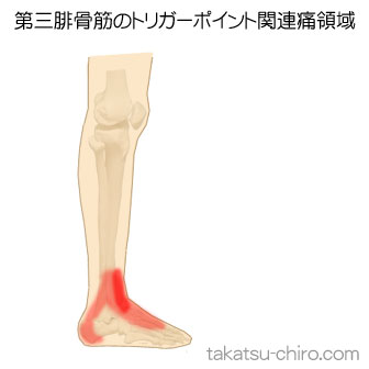 第三腓骨筋の足の痛みの領域