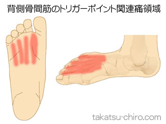 背側骨間筋（足）の足の痛みの領域