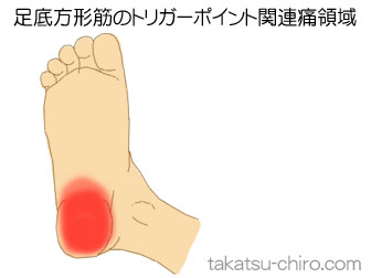足底方形筋の足の痛みの領域