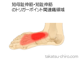 短母趾伸筋・短趾伸筋の足の痛みの領域