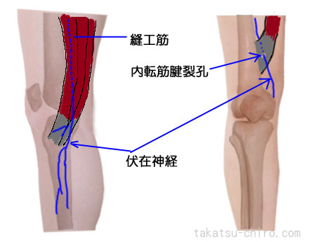 膝下前内側の痛み伏在神経の神経痛