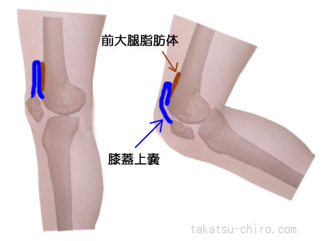 膝前上部の痛み膝蓋上嚢と前大腿脂肪体