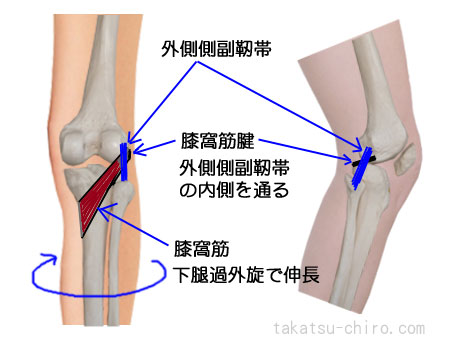 膝後面の痛み膝窩筋