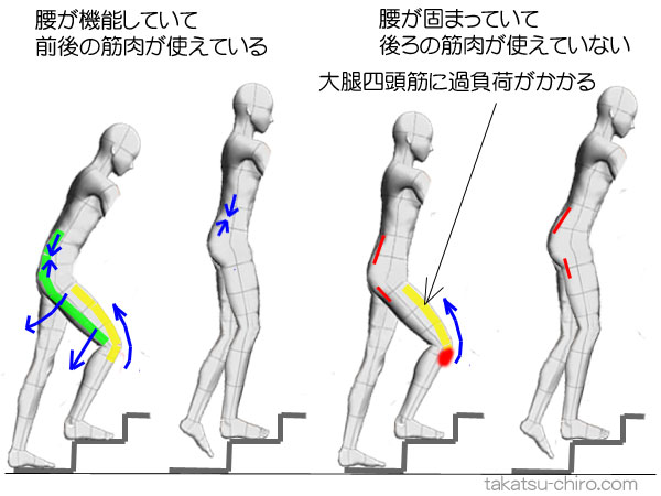 腰からくる膝の痛み