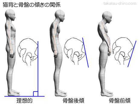姿勢と骨盤の傾きの関係