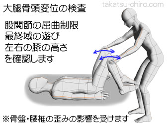 股関節の大腿骨頭変位の検査