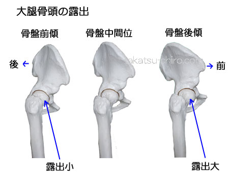 骨盤の傾きと股関節の可動域制限