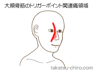 大頬骨筋の顔の痛みの領域