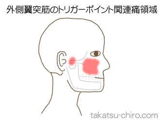 外側翼突筋の顔の痛みの領域