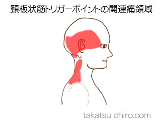 頸板状筋の顔の痛みの領域