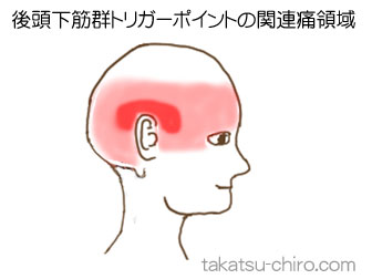 後頭下筋群の顔の痛みの領域