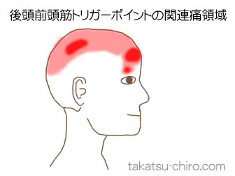 後頭前頭筋の顔の痛みの領域