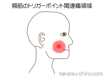 頬筋の顔の痛みの領域