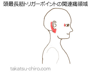 頭最長筋の顔の痛みの領域