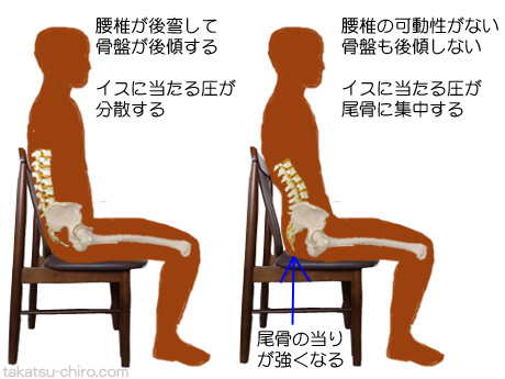 椅子に座ると尾骨が当たって痛い原因