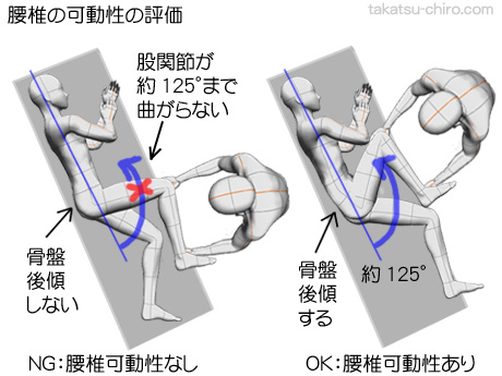 腰椎の可動性や多裂筋の緊張の評価